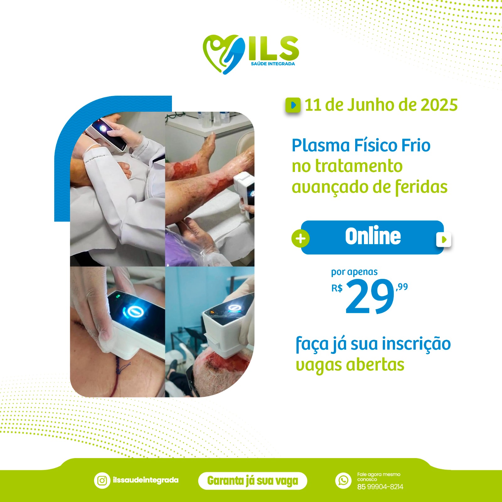 Curso Online | Plasma Físico Frio no Tratamento Avançado de Feridas