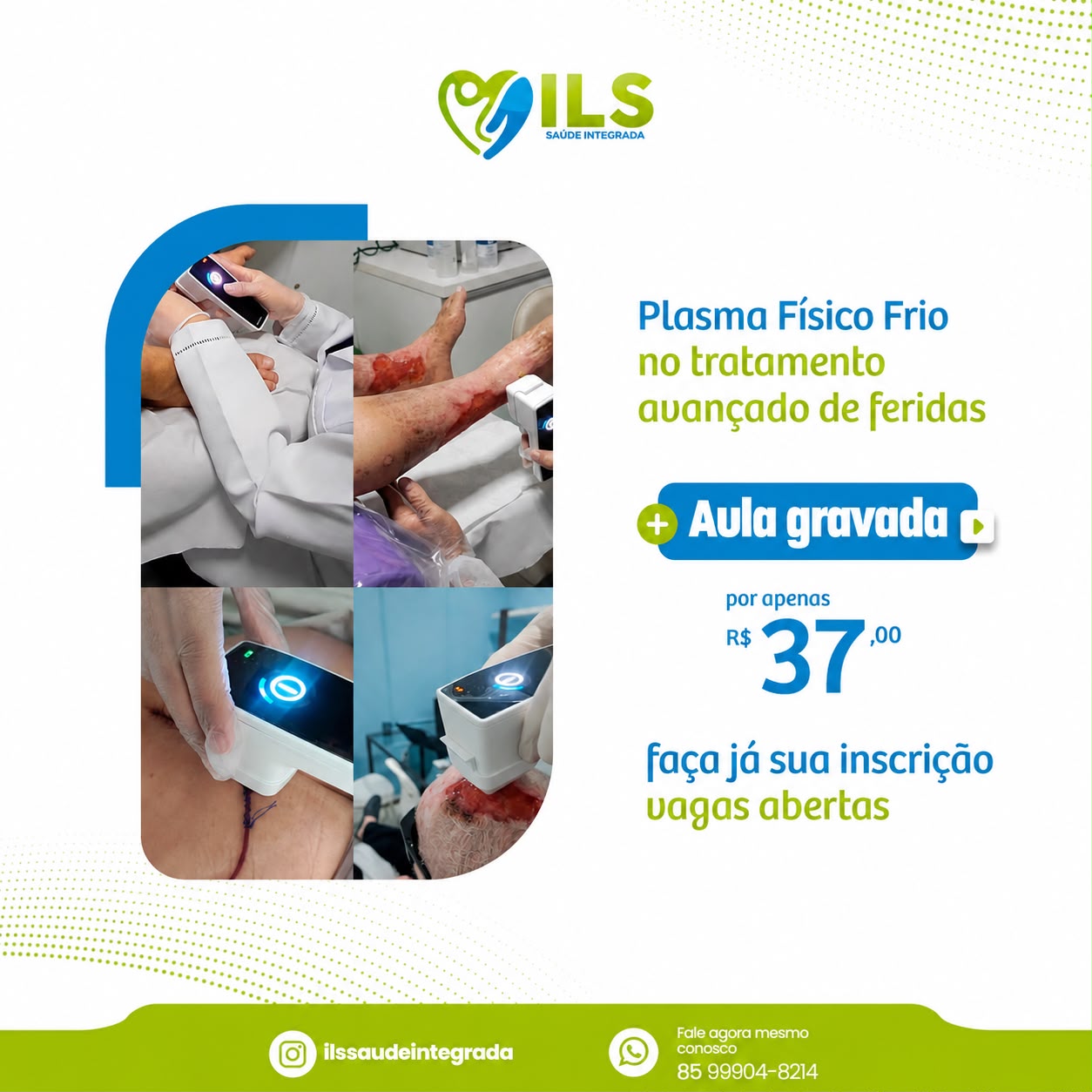 Aula GRAVADA | Plasma Físico Frio no Tratamento Avançado de Feridas